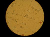 spores E clypeatum1